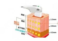 半岛超声炮的功效和作用是很多人想要了解的事情，因为现在的人们想要通过美肤技术来改良皮肤的粗糙皱纹的不良情况，半岛超声炮技术在临床当中应用的比较广，针对性很强，刚接触这项技...