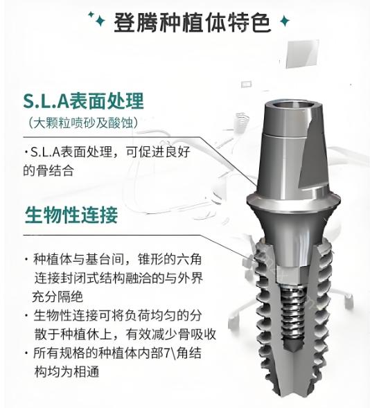 登腾种植体作为韩系种植体的代表，虽然历史不如欧美品牌悠久，但凭借其经济实惠的价格和可靠的质量，赢得了广泛的市场认可。在价格方面，相较于欧美种植体通常12000元起的费用，登腾种植体
