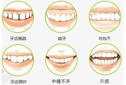 口腔健康是现代人生活品质的重要组成部分，不仅关系到饮食的享受，更与全身健康紧密相连。牙周病、龋齿等口腔问题若不及时治疗，可能会引发更严重的健康问题，如心血管疾病和糖尿病。选