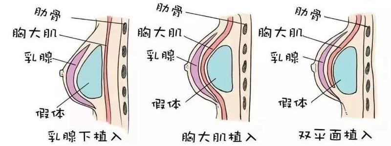 1、长沙法莱丽整形概述 坐落于风景秀丽的湘江之滨，长沙法莱丽医疗美容机构以其卓越的医疗团队和先进的技术设备，成为华中地区整形美容领域的佼佼者。该机构由一支由国内外整形专家、美