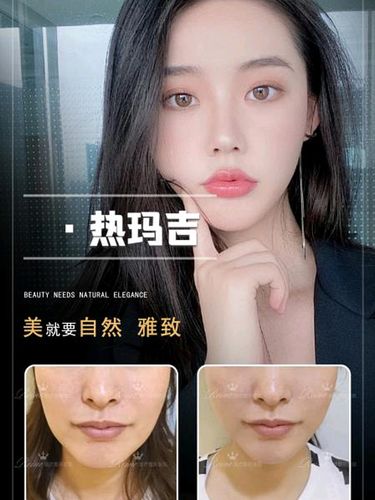 重庆艺星与铜雀台整形比较：哪个效果更佳？在整形美容的领域中，选择一家合适的医院至关重要。重庆艺星和铜雀台整形医院作为当地知名的美容机构，经常被爱美人士提及和比较。两家医院都