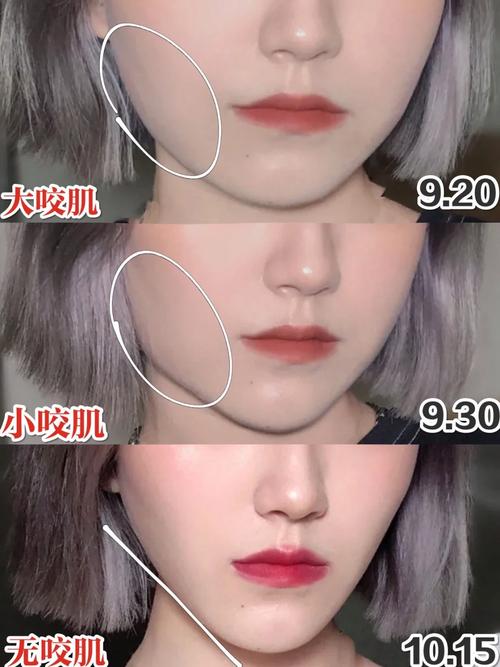 靖江哪里做整形比较好，靖江莱美整形医疗美容诊所、靖江皇开医疗美容诊所、泰州靖江伊美医疗美容门诊部、靖江其莲整形激光美容诊所、靖江其莲激光医学美容诊所、靖江莱美整形美容诊所、