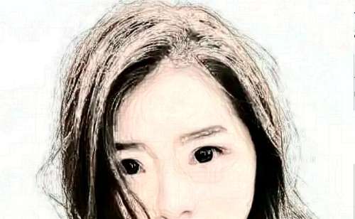 在我们日常生活中避免不了身上留下一些疤痕，比如外伤，手术，烧伤等。对于爱美人来说，小一些的疤痕可以用衣服来遮挡，有些部位的疤痕用衣服遮挡不了，这些疤痕给正常生活带来了很大的不便。所以爱美人士在做疤痕修复时，常常会咨询去疤痕多少钱的问题，那么祛疤手术具体需要多少钱，接下来就跟随小编一起来了解一下去疤手...
