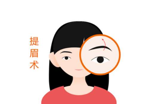 重庆提眉手术好的医生推荐!张家平、王朝奎、樊东力不错，这几位医生在提眉手术方面都有着高超的水准，能够为顾客带来专属服务。提眉手术的核心在于解决上眼睑部位的肌肤松弛、调整眉型，需要调整眉毛的位置以及肌肤的张力。如果医生技术不好，经验不足，很容易导致效果不理想。以下是几位医生的详情分享，不容错过。重庆提...