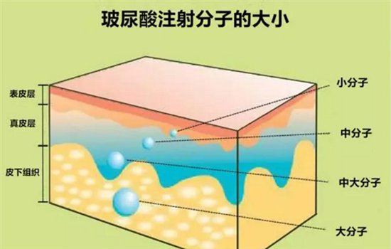 一、哈尔滨伊美尔医疗美容基本信息 医院特色：专注微创美容 医院类型：专科整形机构 热门项目：玻尿酸注射、自体脂肪填充 坐诊医生：王英爽（主治医师，10年临床经验） 医院地址：黑龙江省