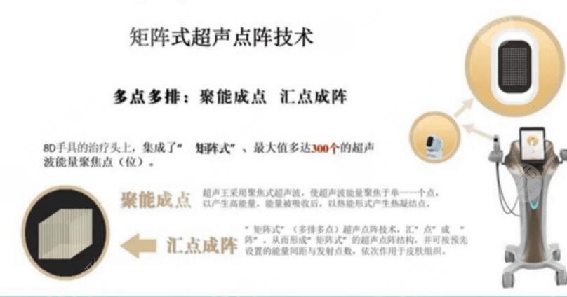 尖峰之星超声王多少钱？