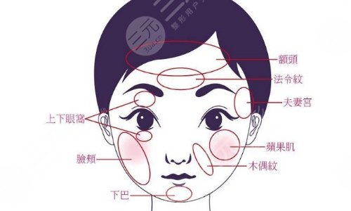 面部轮廓整形需要多少钱？