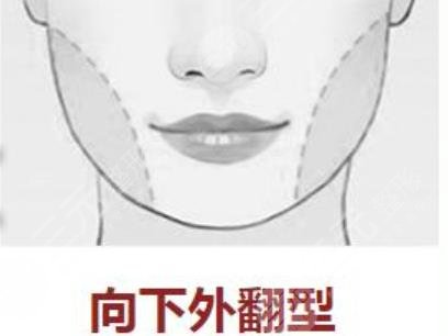 下颌角