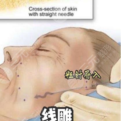 微拉美