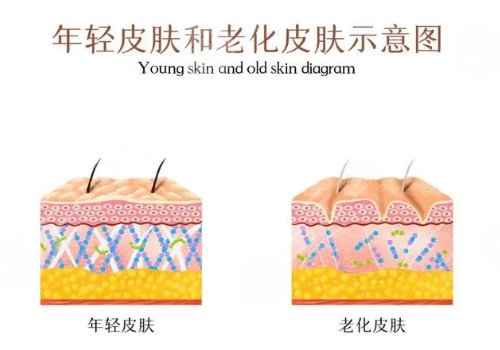 瑞蓝唯瑅打完结块怎么处理