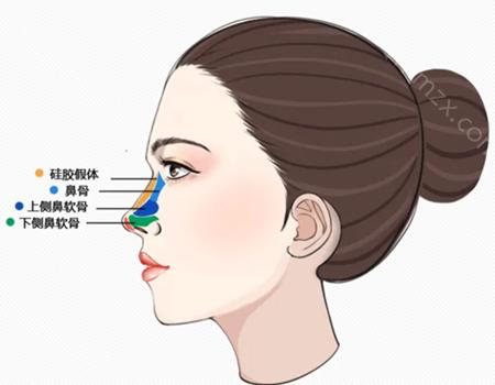 肋软骨填充鼻基底危害是什么?好处和注意事项汇总
