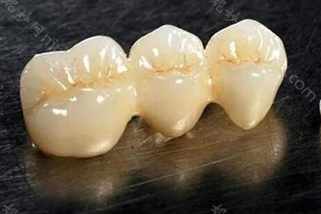 瓷倍健全瓷牙是进口的吗?盘名价格标准/项目介绍