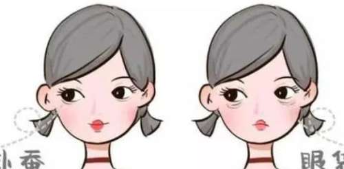 眼袋动漫01.jpg