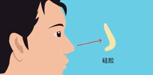 马群