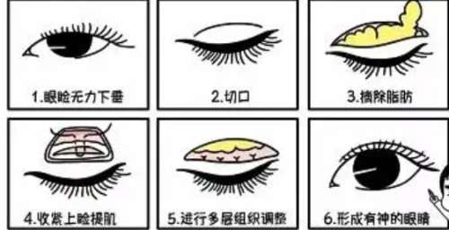 张磊