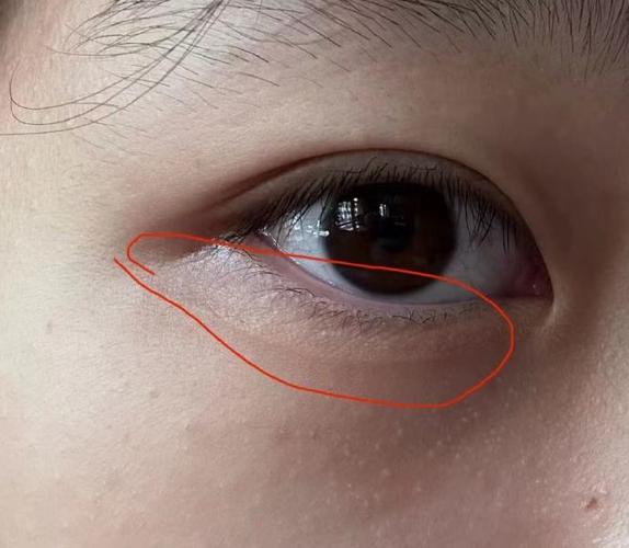 在这个追求美的时代，整形手术已经不再是遥不可及的话题。兰大二院整形外科，作为公立性质的整形科室，以其领先的技术和优质的服务，吸引了众多爱美人士的目光。今天，我们就来聊聊大家
