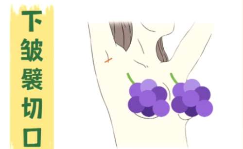隆胸
