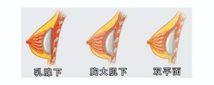 金华亚美整形