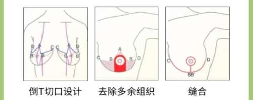 郑州大学第二附属医院