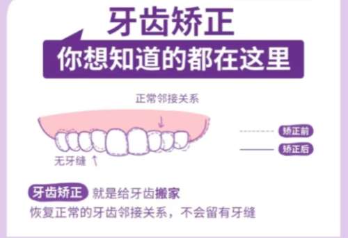 牙齿矫正