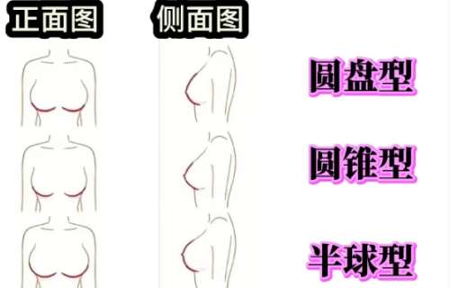 隆胸