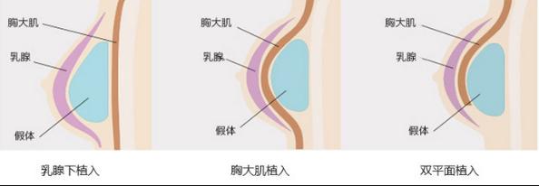 武汉名韩整形医院技术怎么样？在整形美容的领域，武汉名韩整形医院以其精湛的技术和周到的服务赢得了众多求美者的青睐。作为华中地区知名的医疗美容机构，名韩整形不仅拥有国际先进的医
