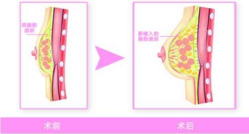 俞积贵医生