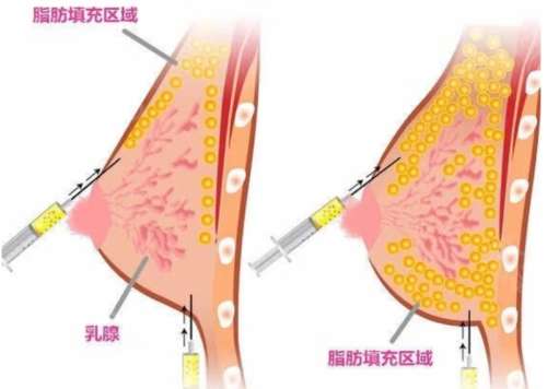 潘伟医生