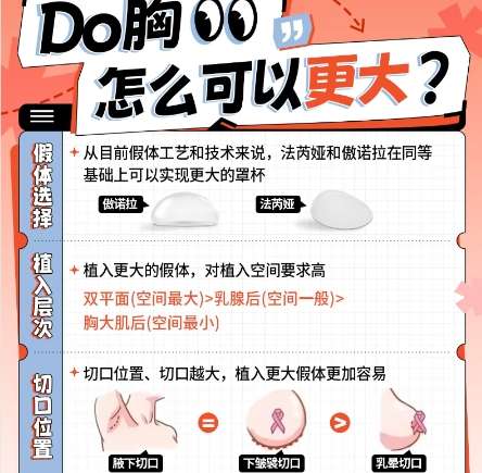 隆胸