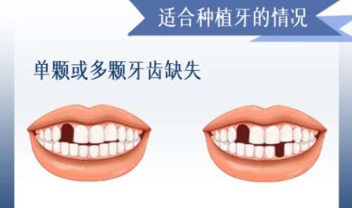 重庆维乐口腔诊所