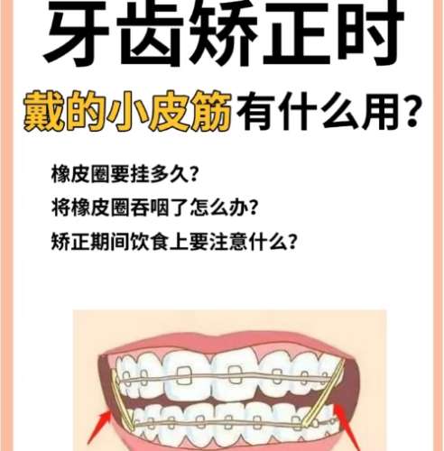 牙齿矫正
