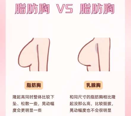 隆胸