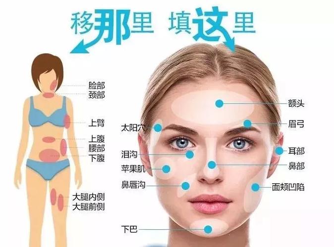 阳江市人民医院整形美容科面部填充技术怎么样？在整形美容的领域里，阳江市人民医院整形美容科凭借其专业的技术和周到的服务，赢得了众多爱美人士的青睐。医院不仅拥有先进的医疗设备和