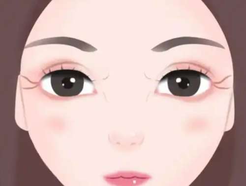 双眼皮