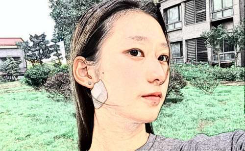 株洲玻尿酸除颈纹技术比较专业的医院有株洲市中心医院整形美容科，株洲华美年华美容医院，株洲雅美整形医院等，有些求美者由于天生的原因导致面部出现了皱纹的情况，还有的求美者在脖子部位出现了颈纹的现象，不管是哪种皱纹，都会给求美者在颜值方面造成一定的影响，所以求美者就想要通过去除颈纹整形手术来进行改善，虽然...