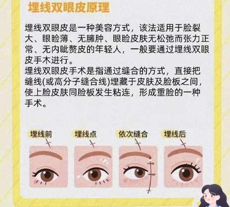 双眼皮