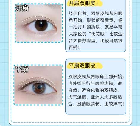 双眼皮