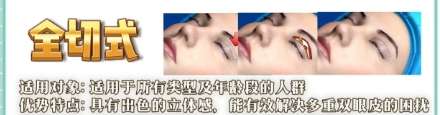 李辉超医生