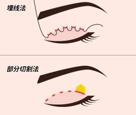 成浩医生