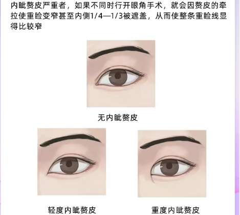 叶英海医生