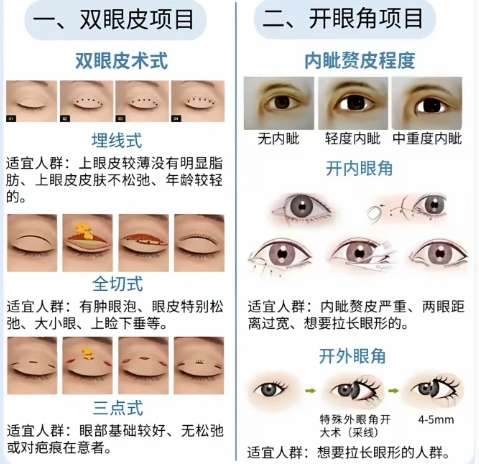 双眼皮