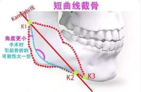 磨骨