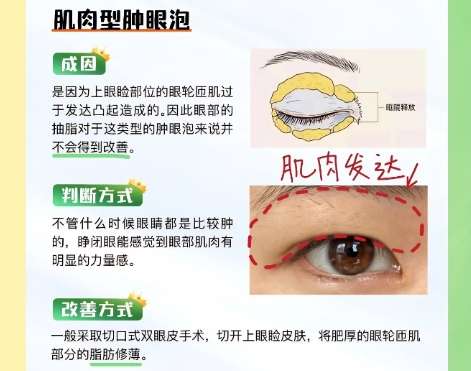 杨娴娴医生