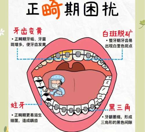 牙齿正畸能够排齐歪歪扭扭的牙齿，改良咬颌关系，对面型改变也起着重要的作用，不管是成年人还是青少年，在牙齿基础情况合适的前提下，都是可以做正畸手术的。对于该项目，很多人存在着困惑，觉得价格昂贵，负担不起。本文将为大家展示无锡市口腔医院正畸价目表，价格区间分布在7274-39515元，不同的矫正方式价格...