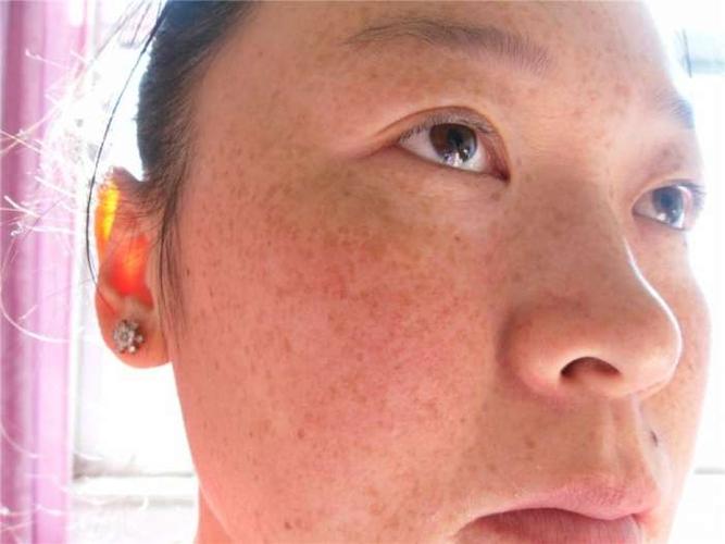 选择一家靠谱又合适的整形医院至关重要。今天，咱们就来聊聊柳州美丽焦点整形医院，看看这家医院的实力如何，价格又是否亲民。 柳州美丽焦点整形医院，这个名字听起来就让人心生向往。它