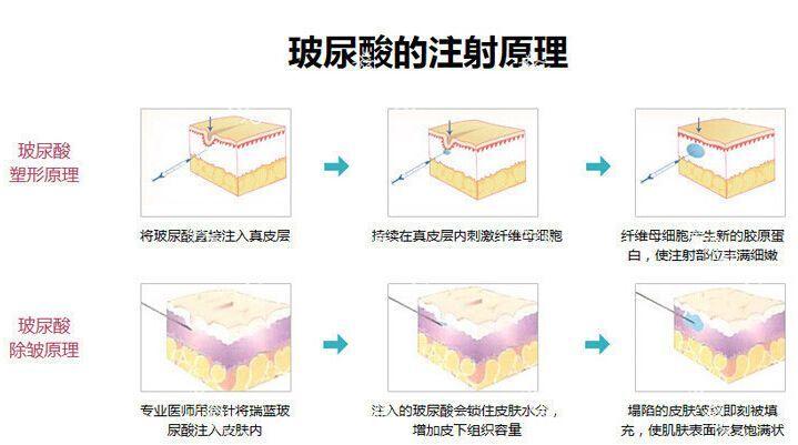 一.沈阳和平赛连医疗美容诊所基本信息 医院特色：医疗美容 医院类型：私立 热门项目：玻尿酸填充、抗衰除皱、眼部整形 门诊时间：周一至周日 9:00-18:00 医院地址：辽宁省沈阳市和平区胜利南