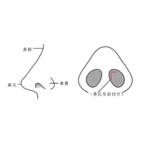 成都鼻整形价格费用多少？鼻子，作为面部五官中的重要一环，其大小和形状往往决定了整个面部的立体感和美感。不少朋友对自己的鼻子不甚满意，希望通过整形手术来重塑鼻形，提升颜值。今