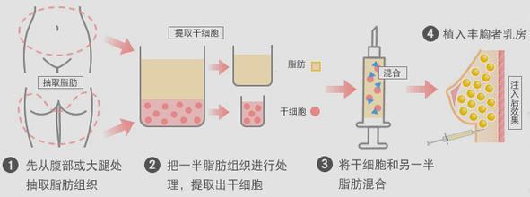 南昌韩美整形医院价格费用多少？都说“岁月是把杀猪刀”，尤其对咱们爱美的女性朋友来说，皱纹简直就是天敌！年纪还没多大，皮肤就开始松弛长皱纹，这可真是让人痛心疾首啊！不过别急，