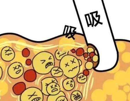 在长沙，抽脂领域藏着不少“曲线雕刻高手”。其中，1.长沙梵童、2.长沙艺脂、3.长沙华韩、4.长沙亚韩、5.长沙美研这五家医院，凭借各有千秋的抽脂技术和良好口碑，成为当地求美者的热门选择。它们有的擅长精准塑形，有的注重术后恢复，今天就来一一揭秘它们的“抽脂秘籍”。长沙抽脂价格表(2025年实时参考)...