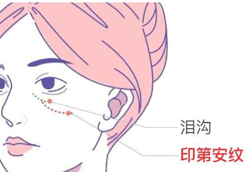 浙医二院填充泪沟价格是多少？7000元左右起|价格实惠！经常熬夜或年龄增大都有可能会引起泪沟问题，显得整个人没有精气神，比实际年龄老了好几岁，相信这是很多爱美者目前所存在的问题，其实想要告别泪沟，可以通过医美填充的方法来进行改良，目前浙医二院在填充泪沟方面的口碑很好，有着经验丰富的医生，可是在迈出变...